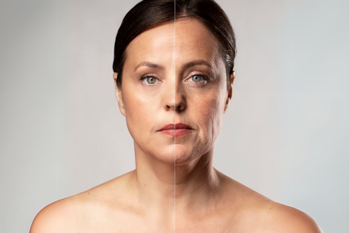 top 5 signs skin is losing collagen